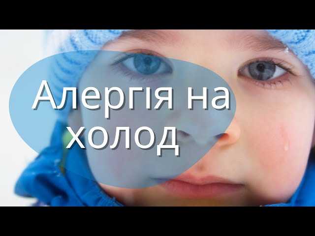 Алергія на холод